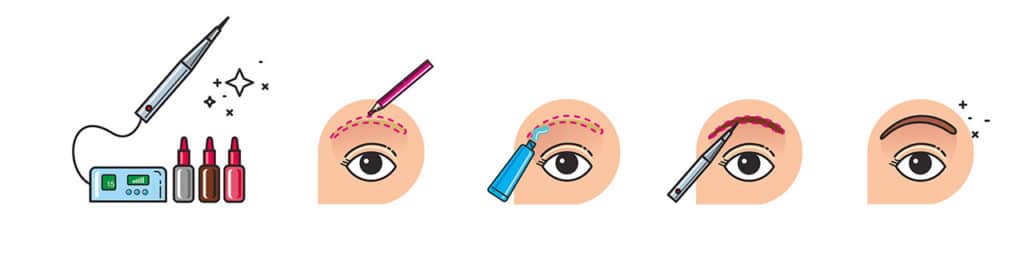 Mikropigmentation Schema